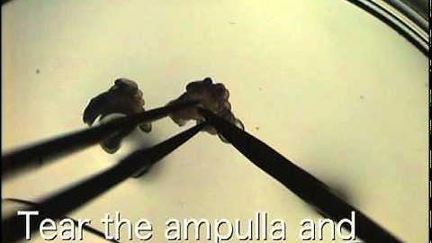 Collection of Oocytes