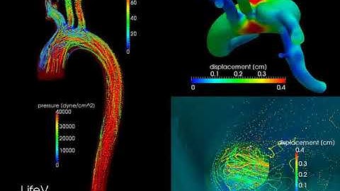 FSI in an aortic arch