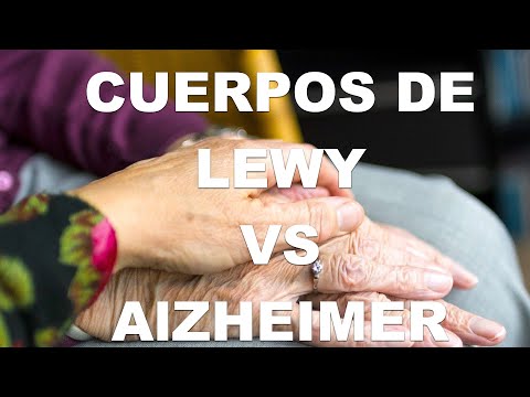 Demencia con cuerpos de Lewy y Alzheimer. Semejanzas y Diferencias.