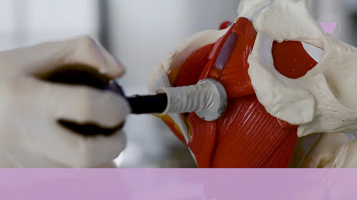 [EN] [WINBACK INTIMITY]Winback Intimity Presentation