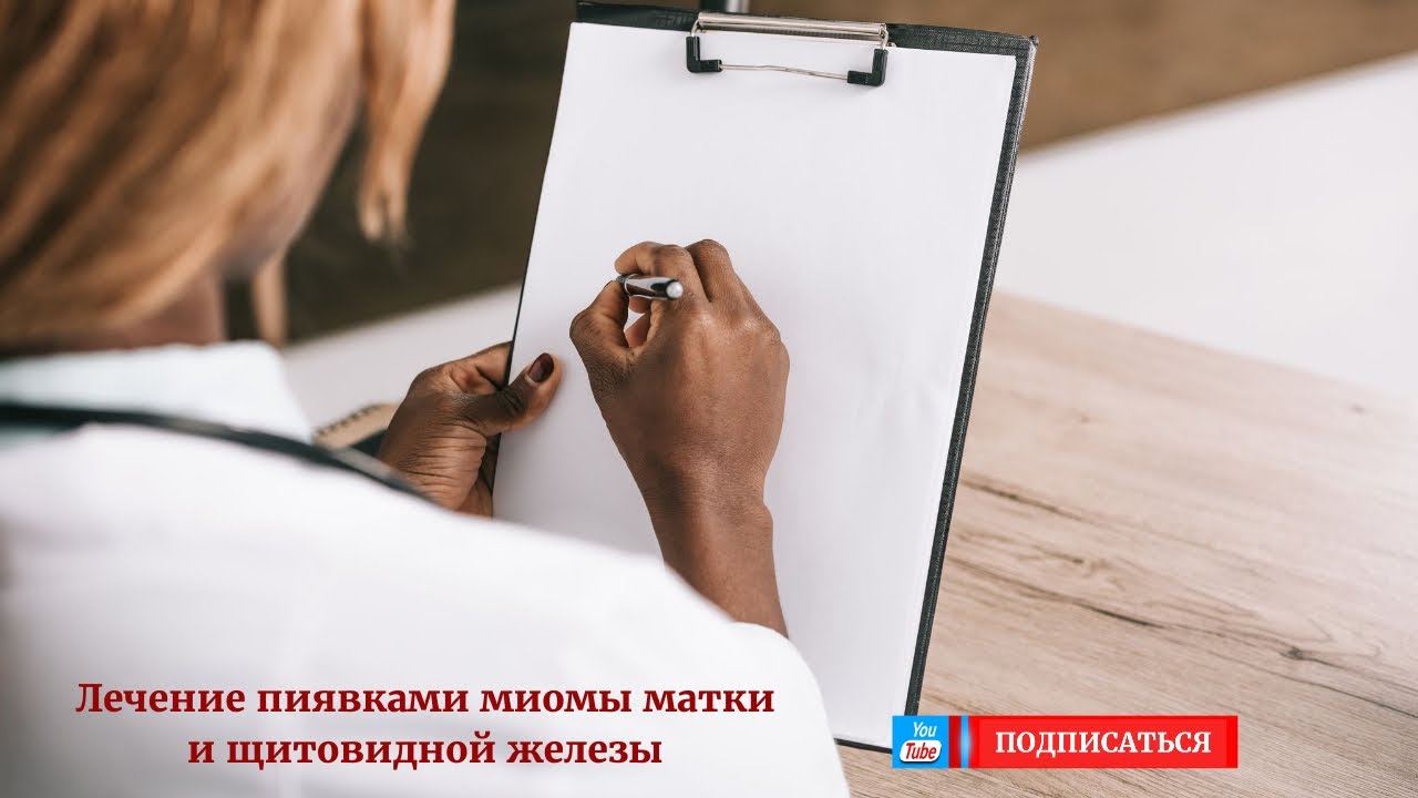 Лечение пиявками миомы матки и щитовидной железы