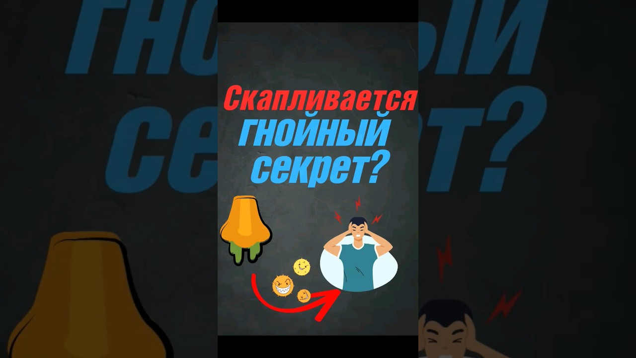 ГАЙМОРИТ.#болезни #гайморит