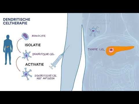 Video: Gelijktijdige Verwijdering Van 3'ETV6- En 5'EWSR1-genen In Neoplasma Van Blastische Plasmacytoïde Dendritische Cellen: Case Report En Literatuuroverzicht