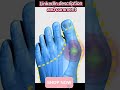 👣Bunion Corrector for Women&amp;Men #BunionCorrector, #FootCare, #ToeAlignment, #PainRelief,#AmazonFinds