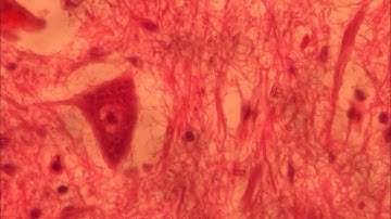 Y2 - THỰC TẬP MÔ HỌC - BUỔI 6. MÔ THẦN KINH [EP.2]. #taylorswift #redtaylorsversion #taylorversion