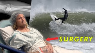 I Tore My BICEP Muscle OFF THE BONE while Surfing by Ben Gravy 44,988 views 1 month ago 25 minutes