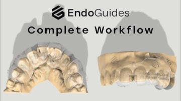 Complete Workflow for Endo Guides: From Starter Kit to Guide Delivery