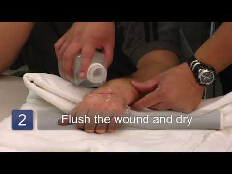 How to Clean a Wound
