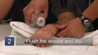 How to Clean a Wound