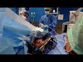 Wybudzenie pacjentki podczas operacji resekcji guza mózgu.
