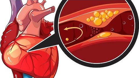 Heart Attack Early Warning Signs | Symptoms You Should Never Ignore