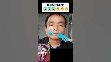 Thumbnail of Respect 💯 #shorts