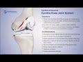 Double medical cynthia knee joint