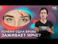 Почему одна бровь заживает ярче?