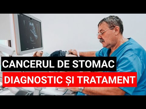 Diagnosticul și tratamentul CANCERULUI DE STOMAC - GRATUITE. Prof.univ.dr. Paul Mitruț