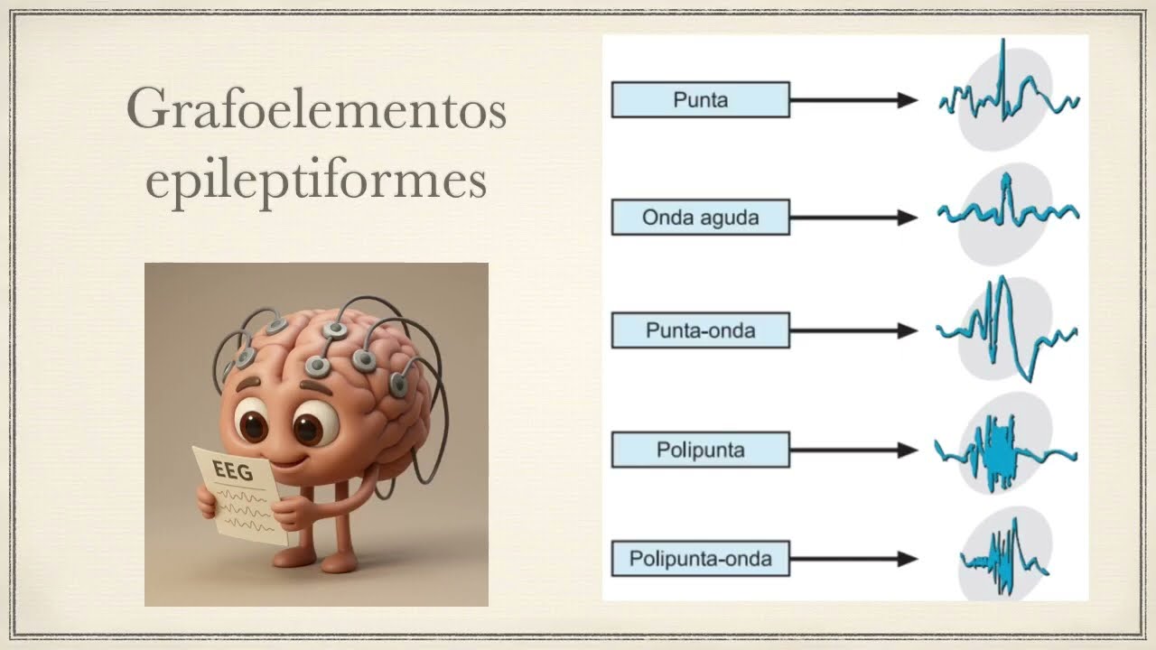 EEG 2: Alteraciones relacionadas con epilepsia