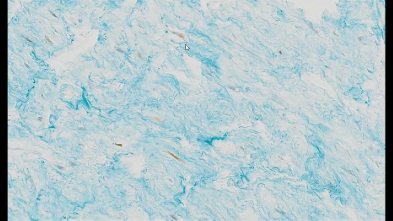 mature-gelatinous-tissue-mallory-s-staining-pums-histology-slides
