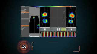 Видеообзор Бароподометрическая беговая дорожка Sensor Medica TREADMILL RunTime XL 