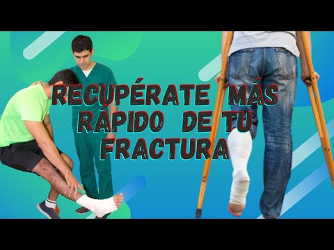 Video: Cómo curar huesos rotos: en el hospital, en el hogar y rehabilitación