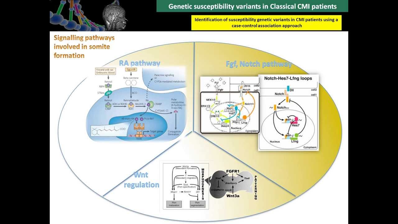Genetic susceptibility variants in Classical CMI patients