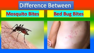 Difference Between  Mosquito Bites and Bed Bug Bites