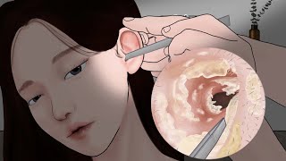 ASMR เพื่อนมือสั่นกำลังทำความสะอาดหู / แอนิเมชั่นเอนโดสโคปทำความสะอาดหู! LULUPANG