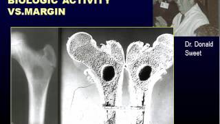 Radiographic Approach to Bone Lesions, Part I