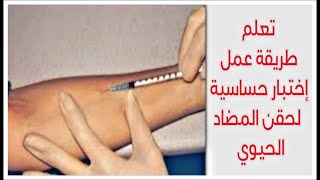 تعلم طريقة عمل إختبار حساسية لحقن المضاد الحيوي (عملي) - Allergy test for antibiotics injection