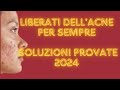 Scopri le Cause dell'Acne e le Nuove Terapie: Guida Completa al Trattamento 2024