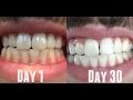 30 Day Oil Pulling Analysis OIL PULLING EXPERIMENTS