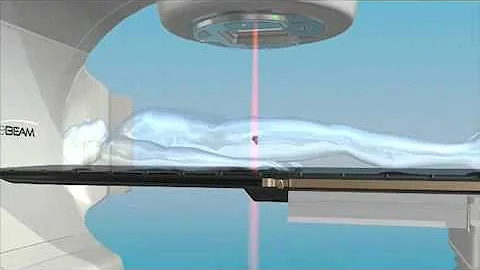 Varian Truebeam IGRT