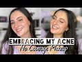 EMBRACING MY ACNE | NO COVERAGE MAKEUP LOOK | Real Skin Makeup Tutorial