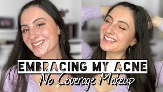 EMBRACING MY ACNE | NO COVERAGE MAKEUP LOOK | Real Skin Makeup Tutorial screenshot 2