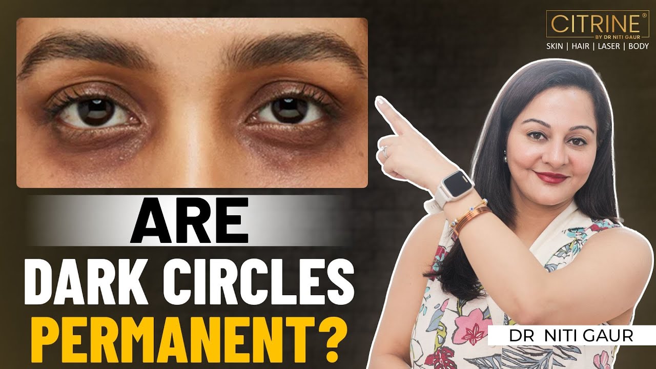Are Dark Circles Permanent? How to Treat Them Effectively | Dark Circles Treatment | Citrine Clinic