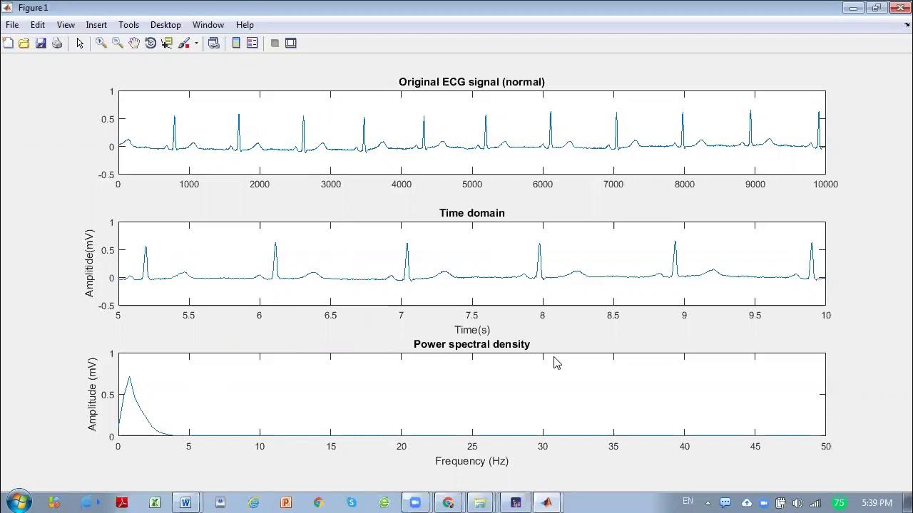 Signal Processing Matlab - How to import raw ECG data from Physionet ...