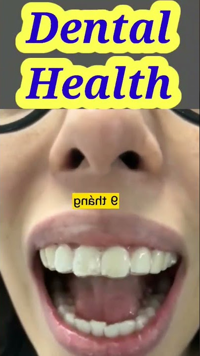 #tiktok #shorts #viral #durecorder #dentistry #instagram #invesline #braces #bgmi #breakingnews #hot