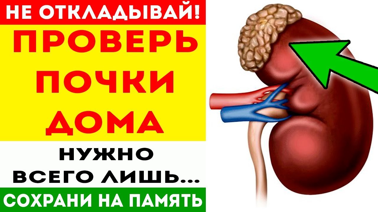 Лечение почек у мужчин в домашних условиях. Проверить работу почек. Проверяем почки в домашних условиях. Где можно проверить почки.