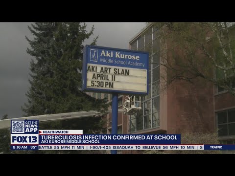 Tuberculosis infection confirmed at Aki Kurose Middle School in Seattle