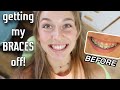 GETTING MY BRACES OFF!