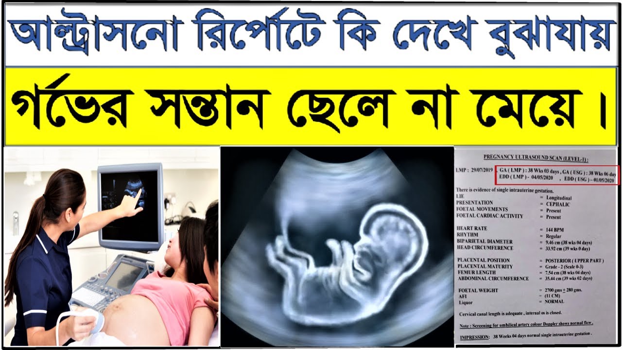How To Know Baby Boy Or Girl In Ultrasound Report How To Know Baby Boy Or Girl In Ultrasound Report