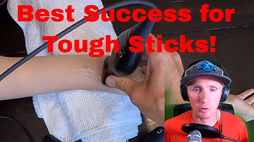 Episode 8- Peripheral vascular access