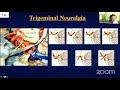 Microvascular Decompression Surgery – Surgical Anatomy and Procedures- Toshio Matsushima