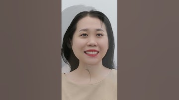 Niềng răng hô và khớp cắn hở | #shorts