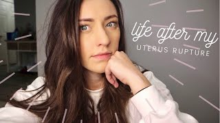 One Year Later ... How I’m Really Doing | Life After Uterus Rupture