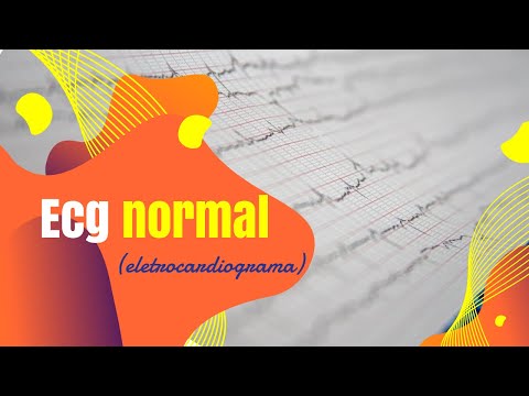 ECG NORMAL | O que é um Eletrocardiograma Normal? (2021) | Dra Patrícia Rueda