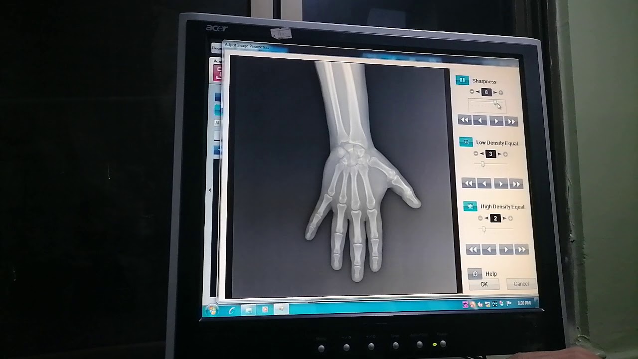 Printing XRay on PET XRay Sheet from Canon 1010 Inkjet Printer Image Pilot X Ray software Instru
