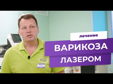 Лечение варикоза лазером. Эффективные современные методы.