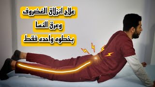 تمرين سحرى لعلاج الانزلاق الغضروفي فى اسفل الظهر | علاج عرق النسا وانزلاق الغضروف بين الفقره ٤ و ٥