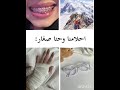 معليكم من الاغنيه مالقيت اغنيه ثانيه المهم وش رايكم لايك احبكم متابعيني معليكم من الاغنيه مالقيت اغنيه ثانيه المهم وش رايكم لايك احبكم متابعيني