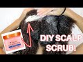 DIY Scalp Exfoliating Scrub for Dandruff, Flakes, Patches, Etc.! | Natural Hair Type 4
